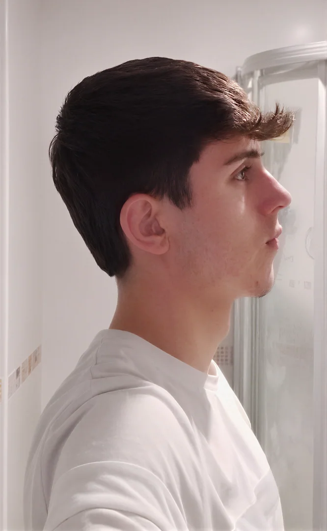 Ignacio — antes