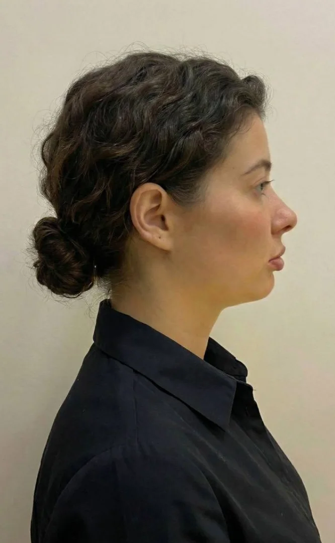 Isabel — antes