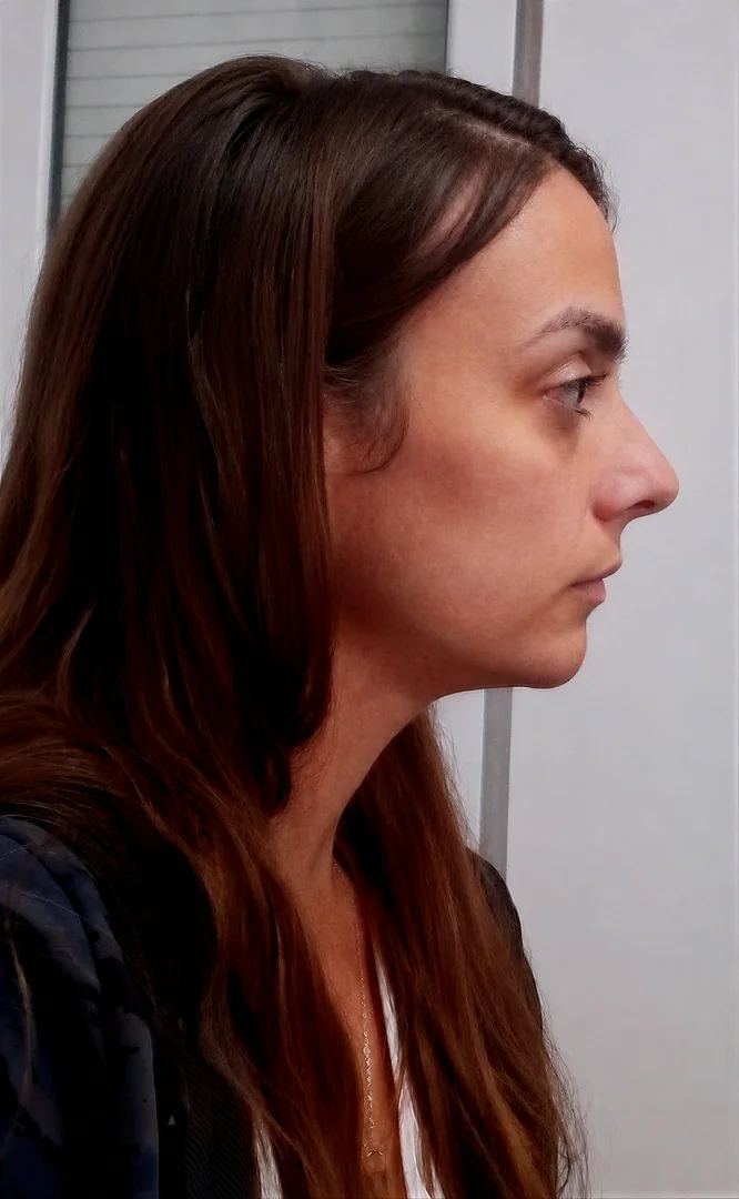 Lucía — antes