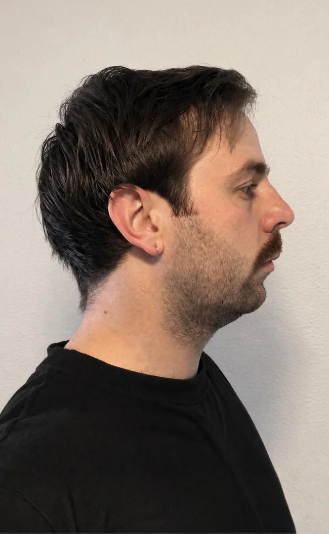 Pablo — antes